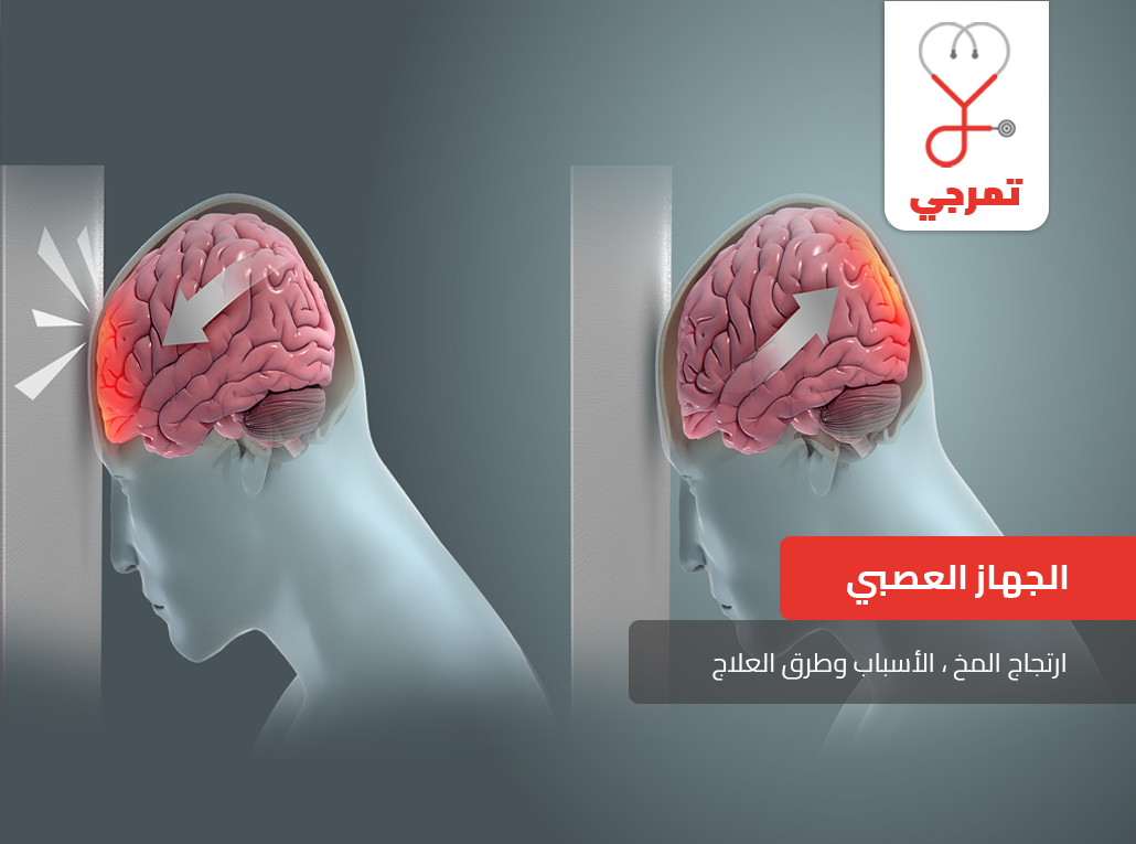 اعراض ارتجاج المخ