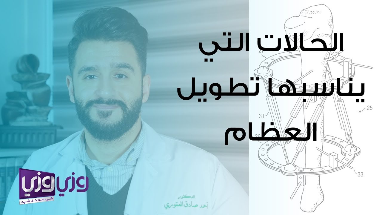 تطويل العظام طبيعيا،الاختلاف في تطويل العظام بالعلاج الطبي والعلاج الطبيعي 9304 1