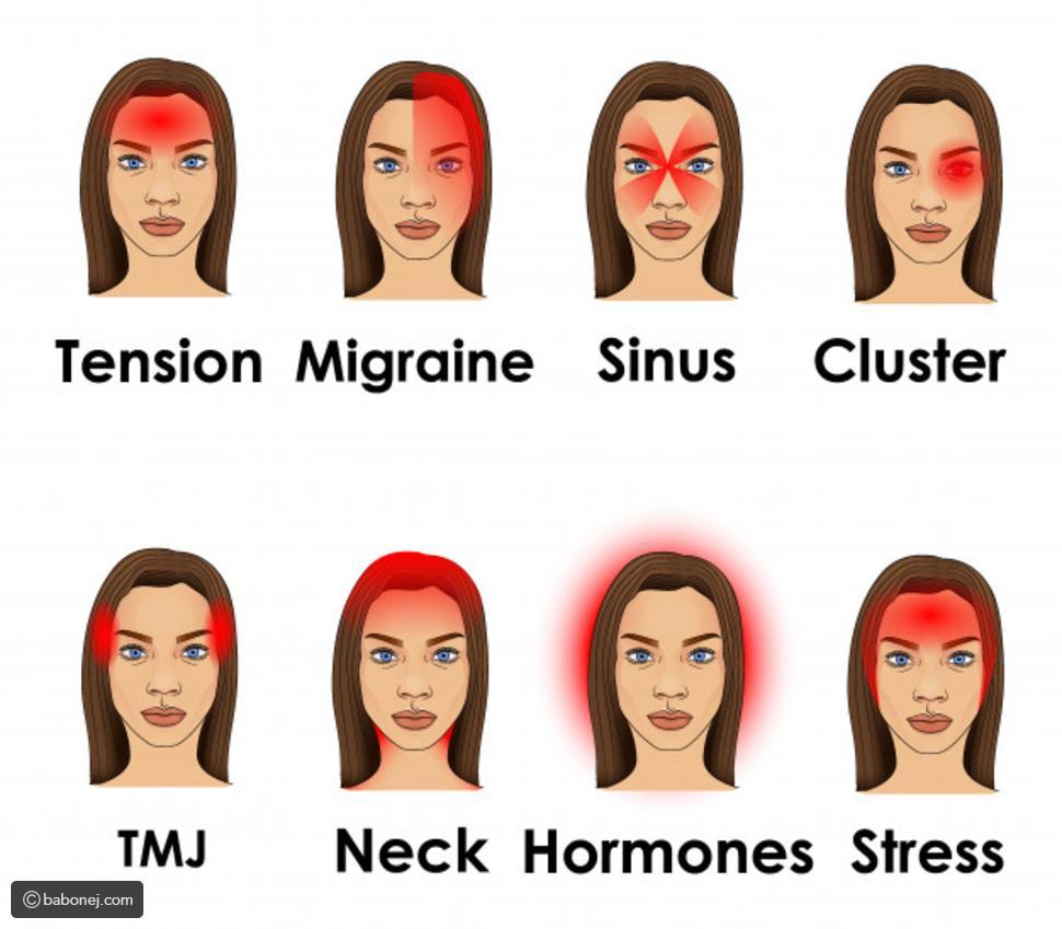 انواع صداع الراس- دماغى هتتفرتك 10229 1