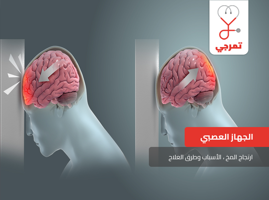 اعراض نزيف الدماغ بعد السقوط،اعراض الارتجاج في الراس للكبار وللاطفال 9274 2