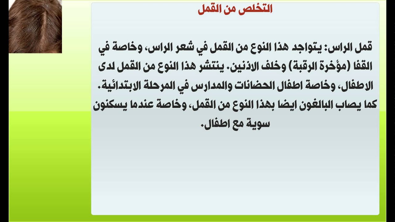 طريقة التخلص من القمل في يوم واحد - جربي تلك الوصفه وسوف تندهشي من النتيجه 10713