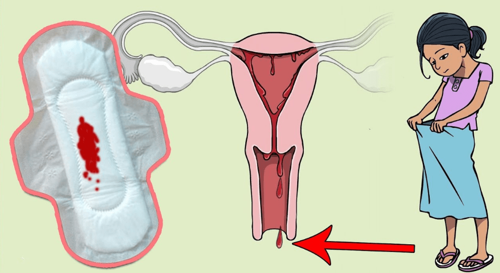 اسباب نزول قطرات الدم في غير موعد الدورة الشهرية , نزول دم بغير موعد الدورة الشهرية