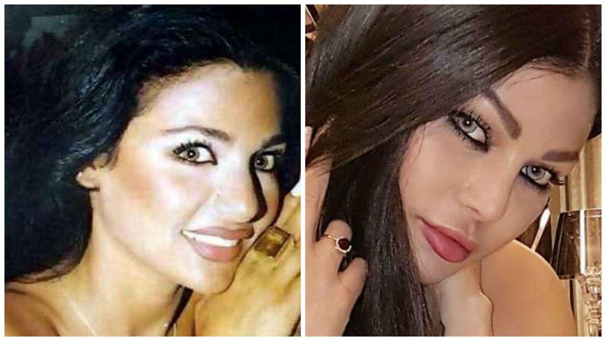 صور هيفاء وهبي قبل عمليات التجميل , هل تلجاء الفنانات لتغير ملامحهم