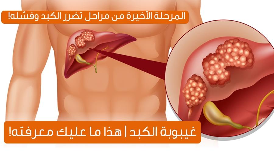 اعراض غيبوبة الكبد , ما هو تسلسل الاحداث للوصول الى غيبوبه الكبد