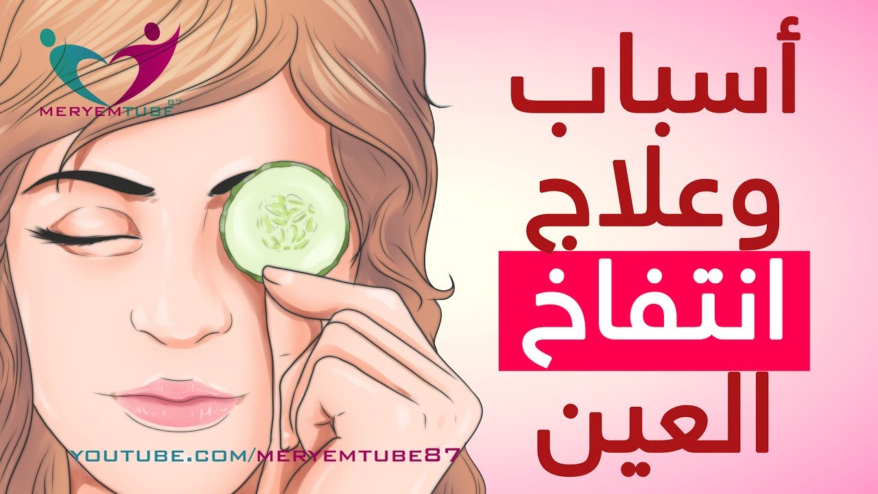 اسباب تورم العين عند الاستيقاظ،اسباب انتفاخ العين 9183 1