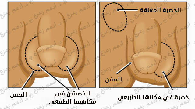 حجم الخصيتين الطبيعي ، احجام الطبيعه للخصيتين 9892 2