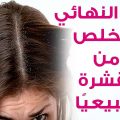 9250 3 للتخلص من قشرة الشعر،تعريف قشره الشعر واسبابها وطرق العلاج منها اشهر Ashhr